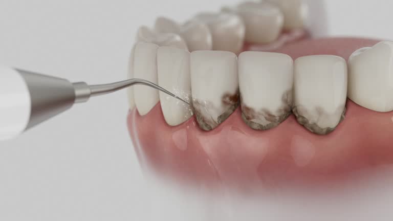 Reliable Dental Implants contractor in Meadview, AZ by Smile Center Dentistry